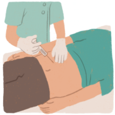 リブロファズ®