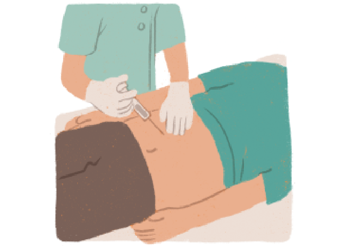 リブロファズ®