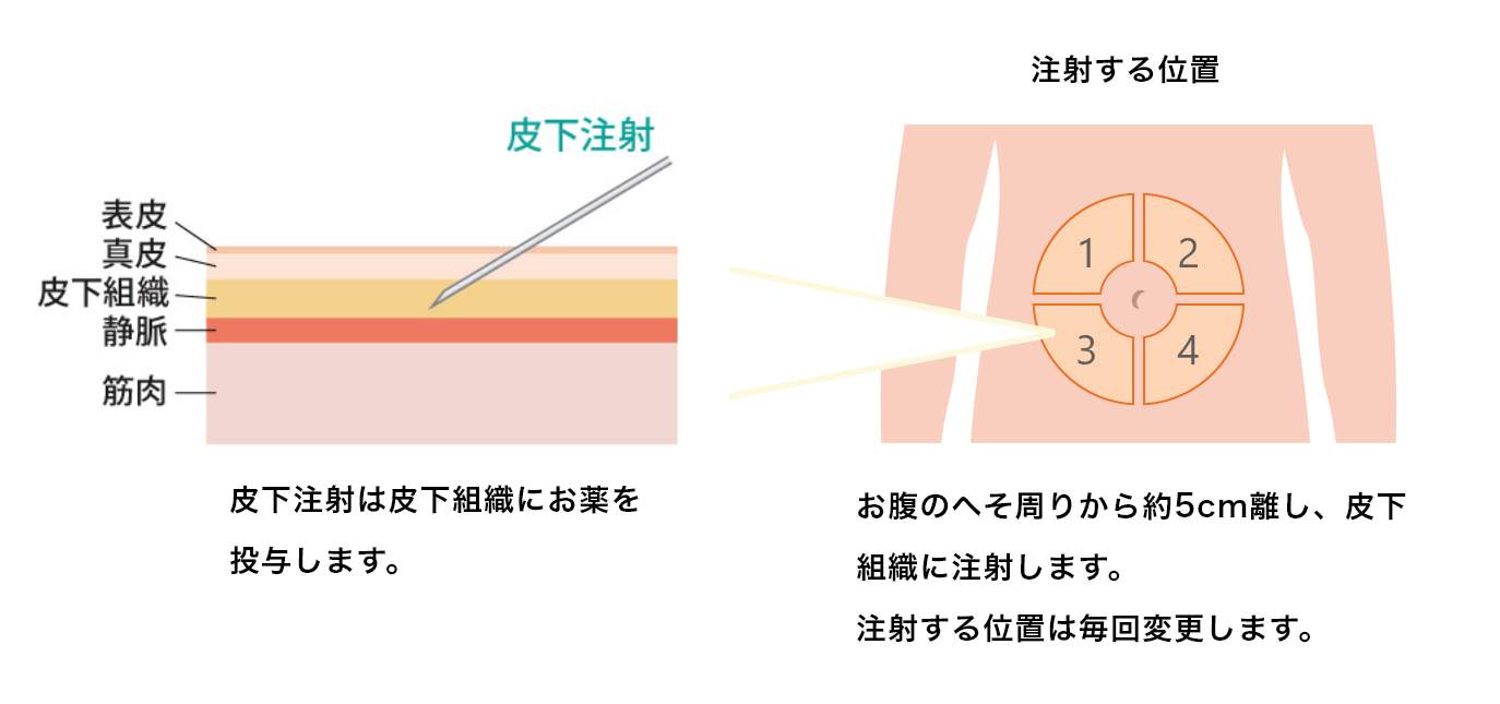 リブロファズ®