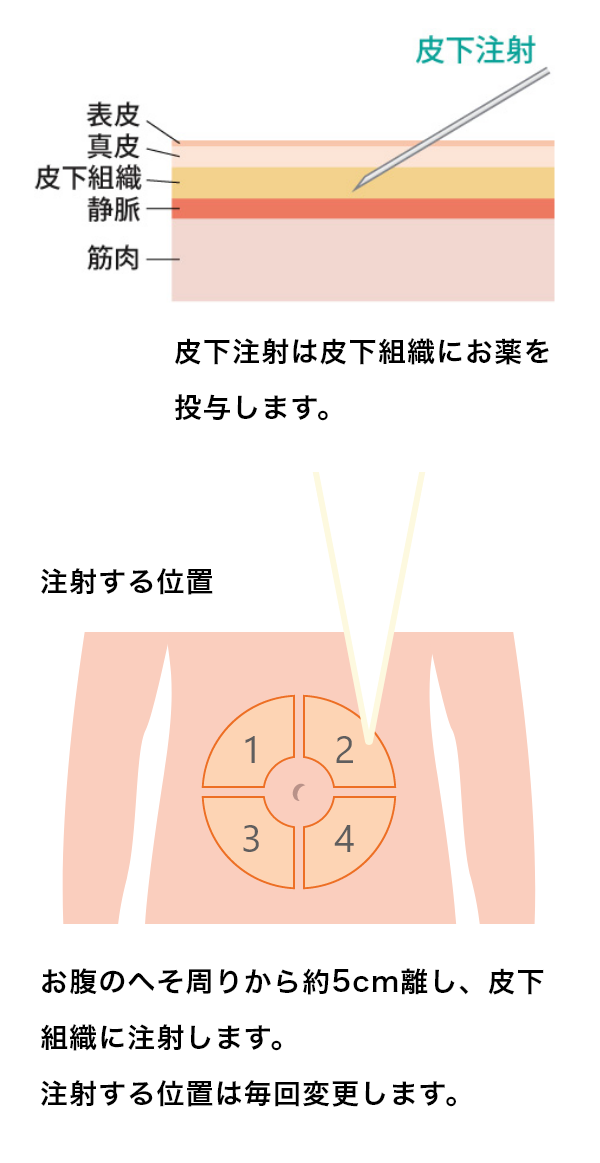 リブロファズ®