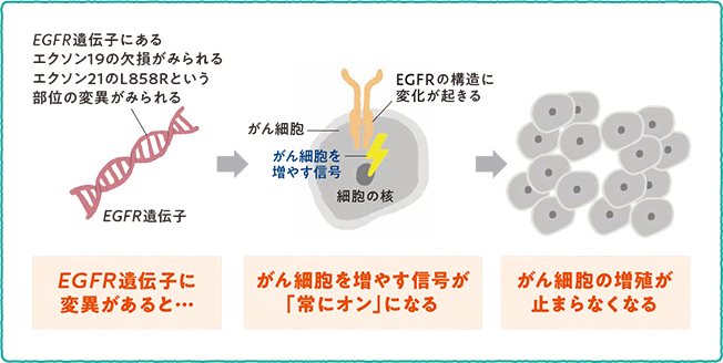 EGFR遺伝子とがんの関係