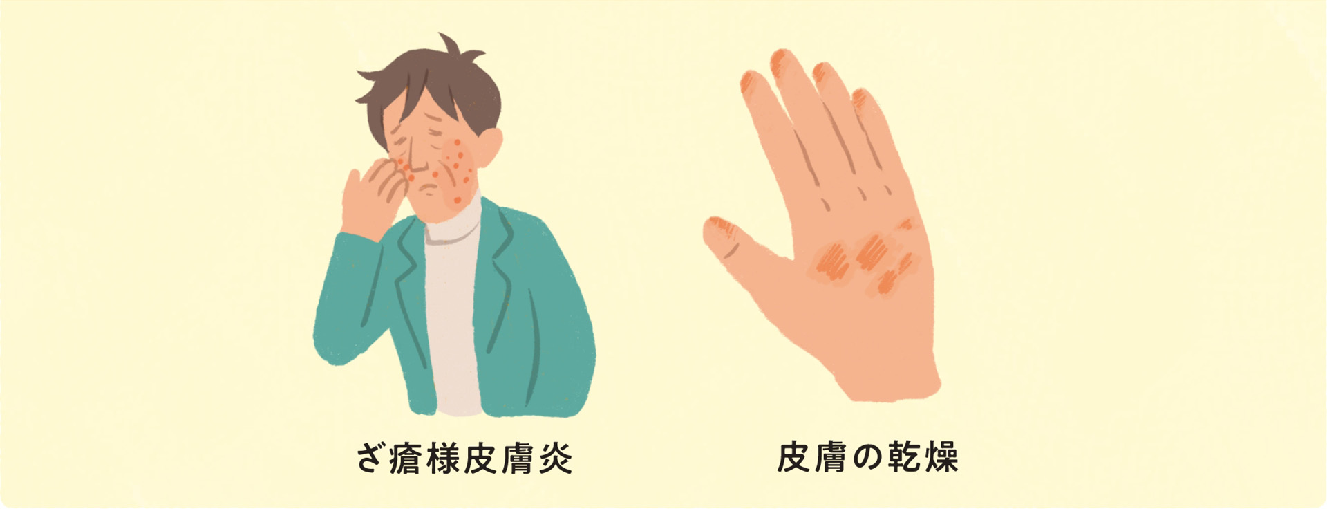 重度の皮膚障害 発疹・ざ瘡様皮膚炎・皮膚の乾燥