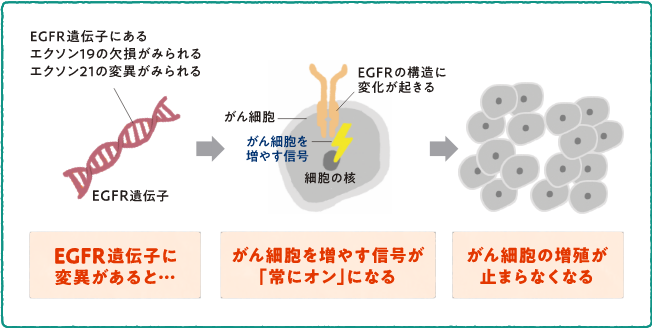EGFR遺伝子変異の種類