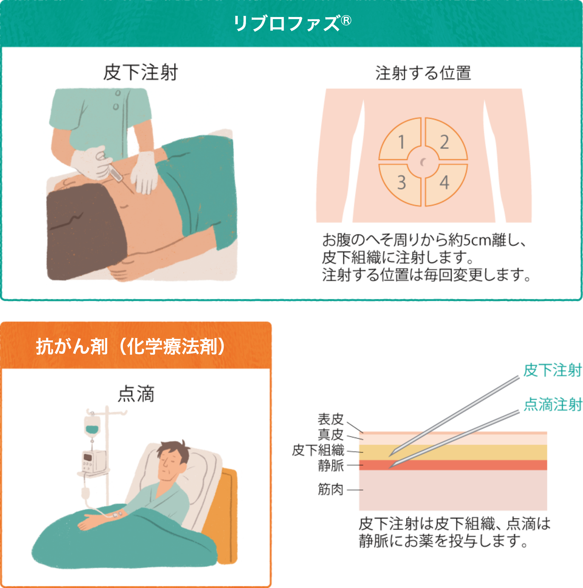 リブロファズ®による治療の投与方法