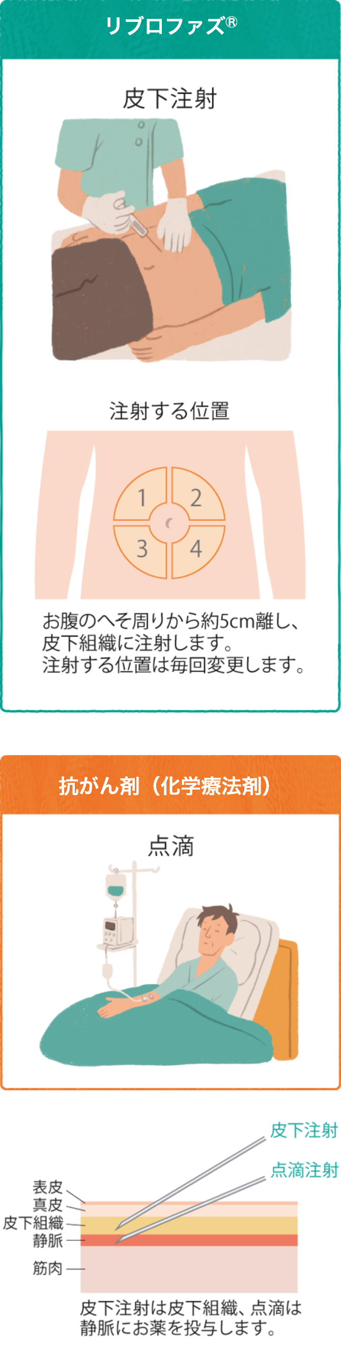 リブロファズ®による治療の投与方法